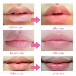 Lip gel mask - anti-wrinkle - moisturiser - collagen patches - 5 - 7 - 10 pieces