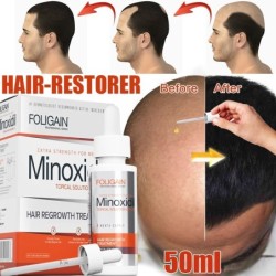 Ätherisches Haarwachstumsöl - Anti-Haarausfall-Flüssigkeit - Serum