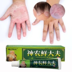 Natürliche chinesische Medizin - antibakterielle Creme - Psoriasis - Ekzem - Kräutersalbe - 15g