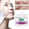 Littekenverwijderingscrème - striae - acne - gezichts- / lichaamsbehandeling - 50 mlHuid