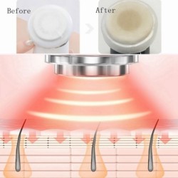 Electric face massager - skin rejuvenation - lifting - wrinkle removal - mesotherapy - electroporation - LEDSkin
