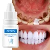 Teeth Whitening serum - gel - oral hygiene - toothpasteTeeth Whitening