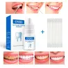 Teeth Whitening serum - gel - oral hygiene - toothpasteTeeth Whitening