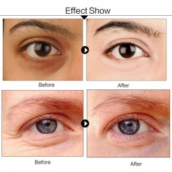 Collageen kristal oogmasker gel - anti rimpel - donkere oogleden verwijderaar 120 stuksHuid