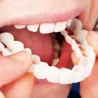 Silicone teeth cover - denture 2 piecesMouth